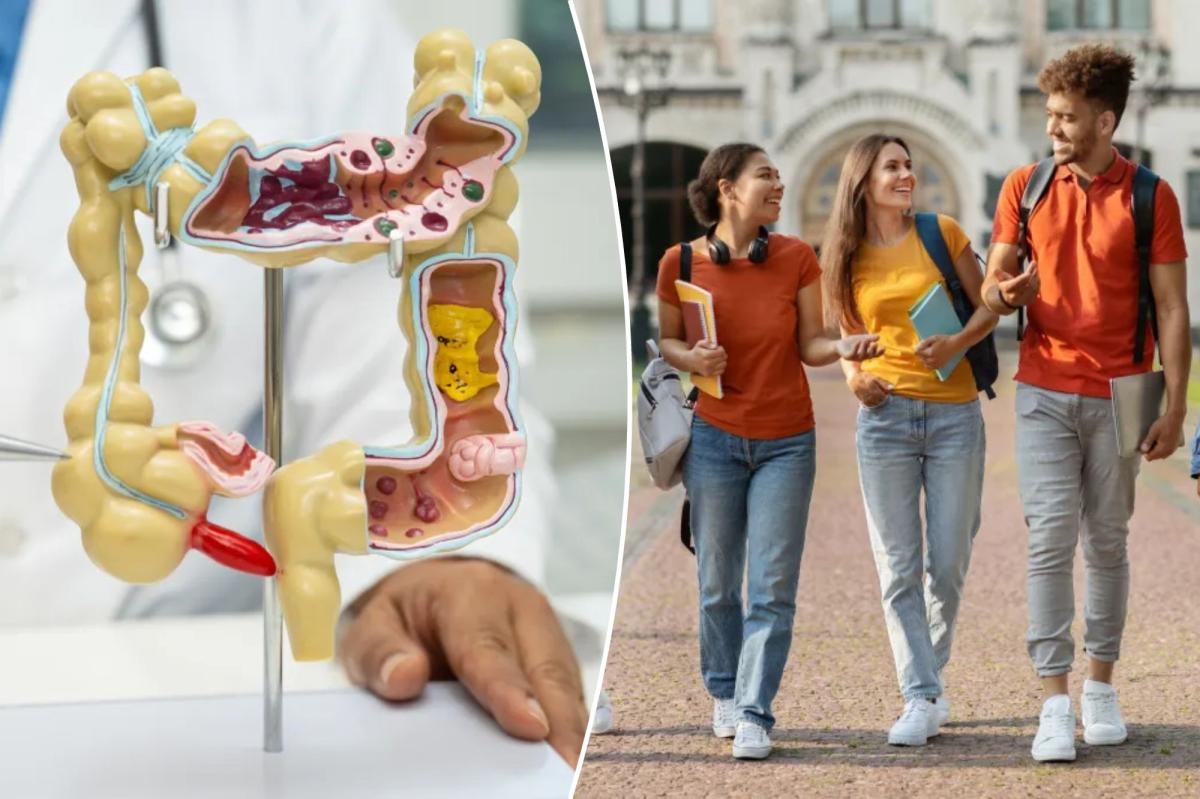 دراسة: ارتفاع وفيات سرطان القولون بين الشباب يتركز لدى غير الجامعيين