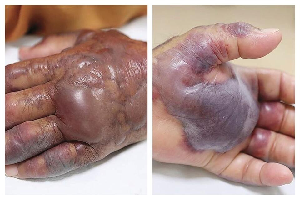 عثور جديد على بكتيريا خطيرة في مياه هذه الأماكن بنيويورك