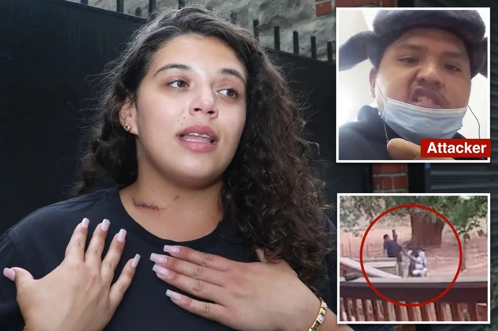 أم من نيويورك تروي نجاتها من طعن وجرح بالرقبة خلال رحلة مشي في محمية هافاسوباي بأريزونا