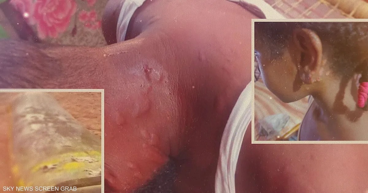 السودان: وثائق مزعومة تربط الجيش بتطوير ذخائر كيميائية واتهامات باستخدامها ضد الدعم السريع