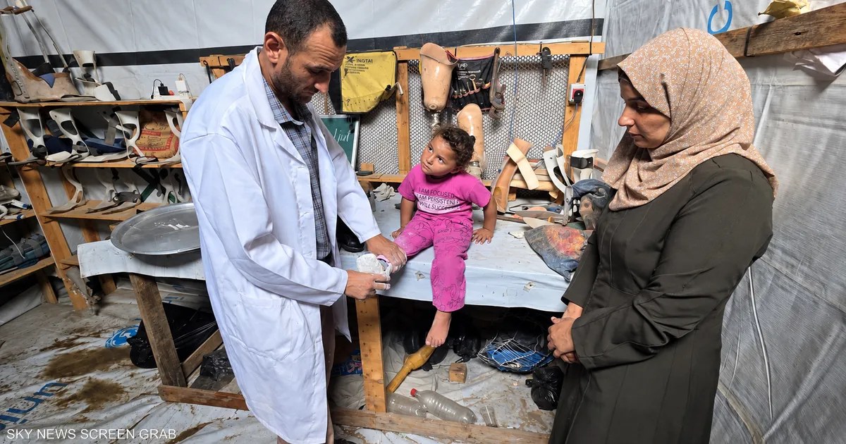 ورشة أطراف صناعية في فلسطين تساعد أطفال غزة على الحركة