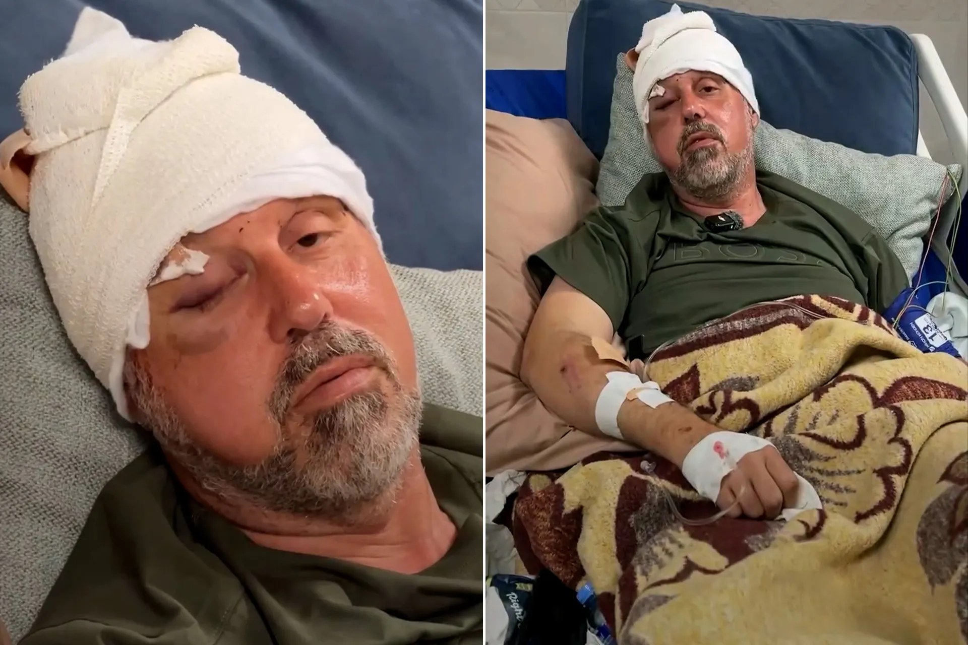 اعتداء مستوطنين في فلسطين يصيب فلسطينيًا أمريكيًا بجروح في رأسه استدعت نحو 200 غرزة